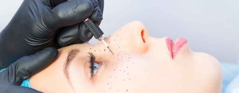 Permanent,Microblading,Tattooing,Freckles,To,A,Woman,In,A,Beauty